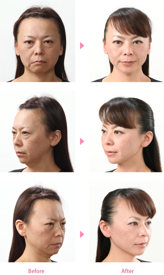 No42_6枚比較写真-大